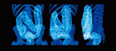 L’arma vincente non esiste, ma di cancro non moriremo più