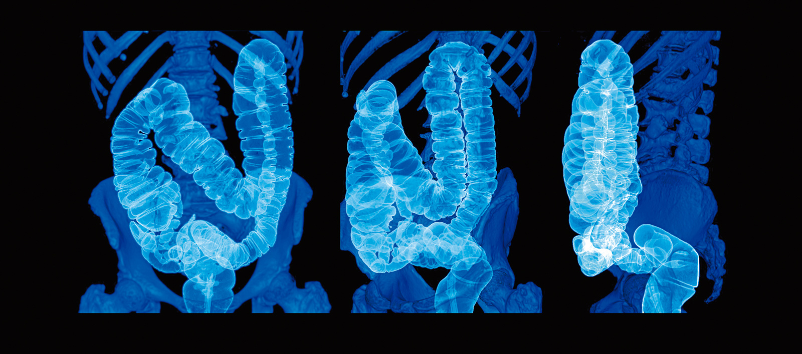 L’arma vincente non esiste, ma di cancro non moriremo più L’arma vincente non esiste, ma di cancro non moriremo più