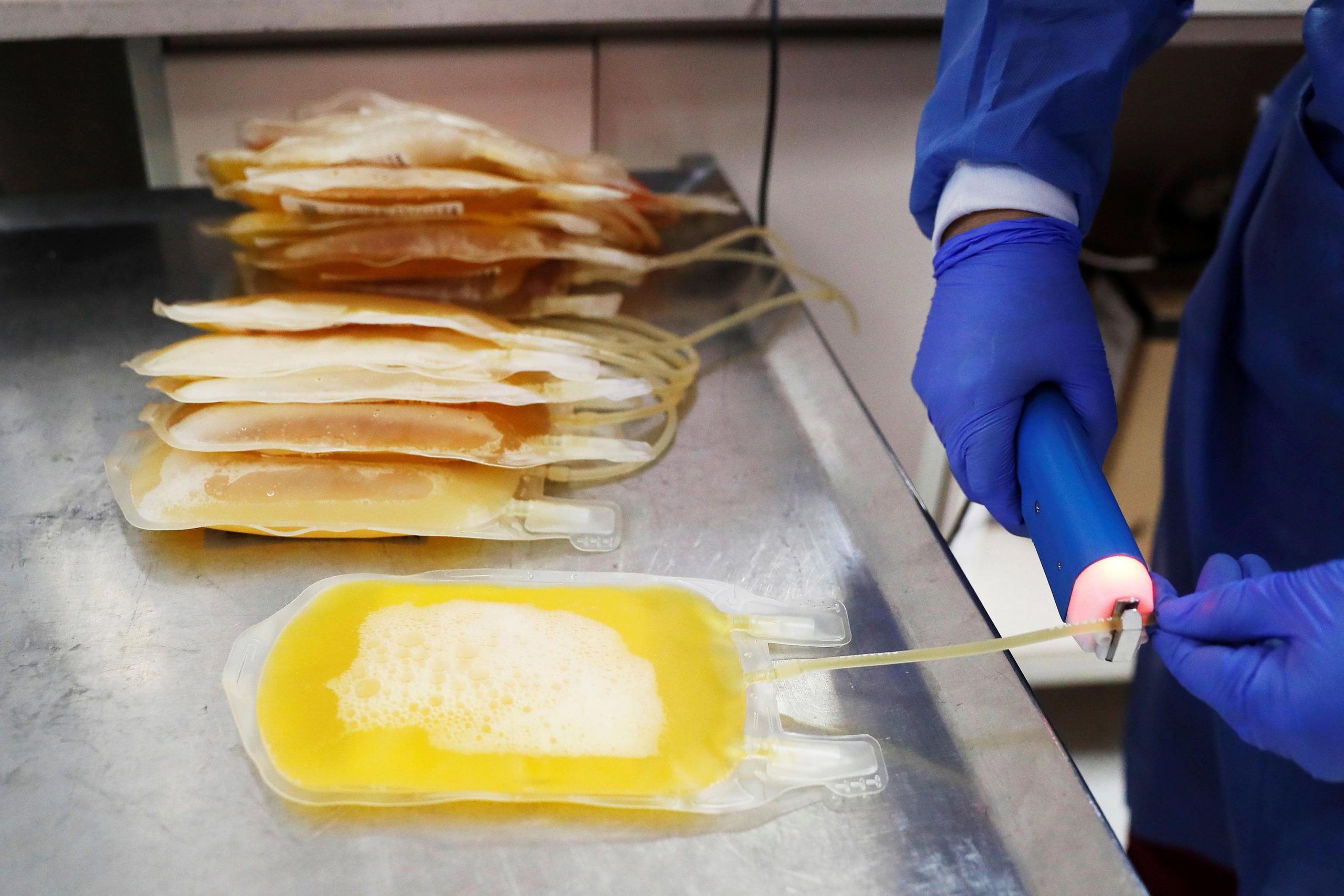 Scienza e medici divisi sul plasma degli immuni contro il Covid