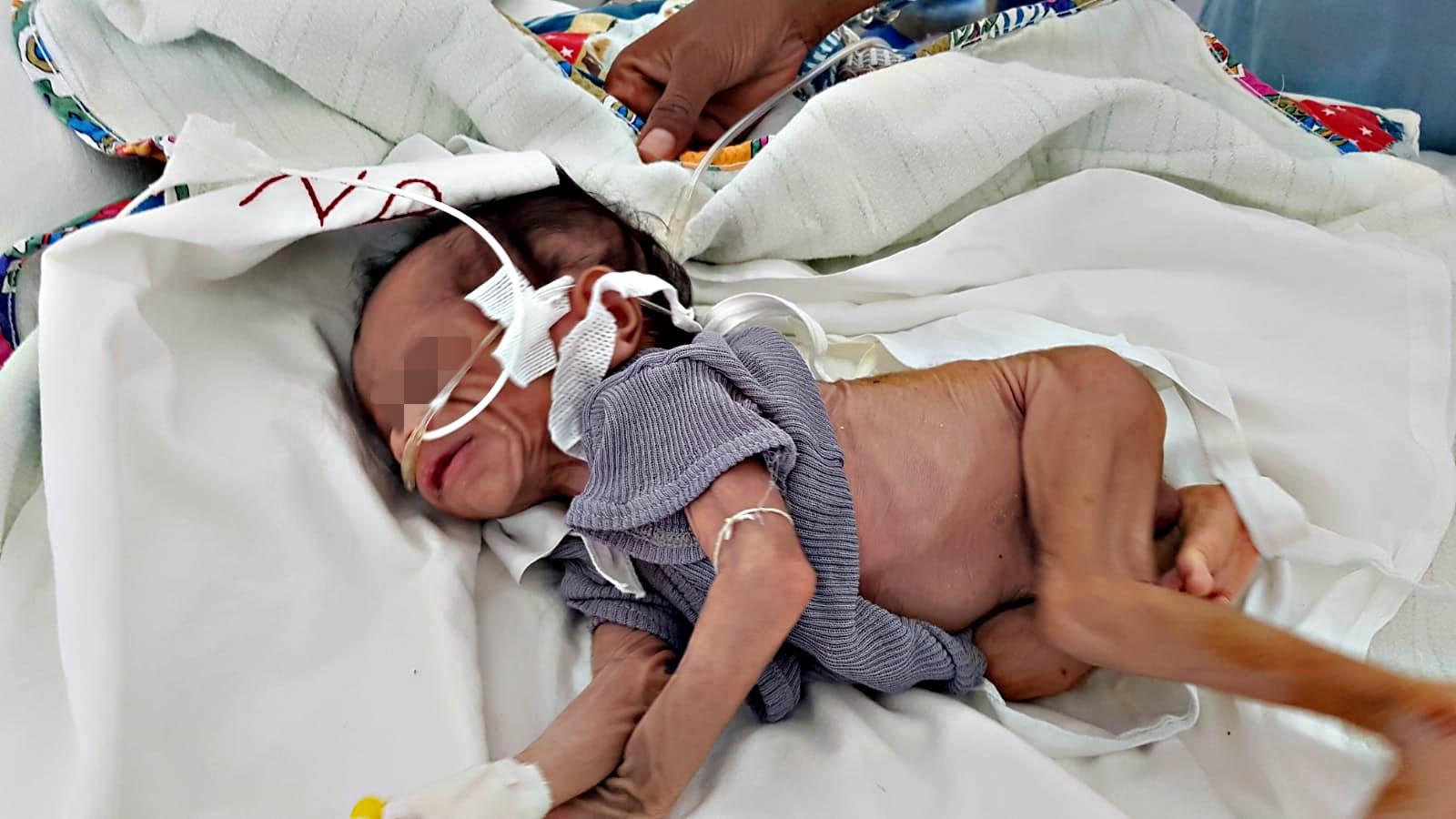 Tigray: le foto che confermano i bombardamenti di Macallè