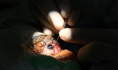 Nuove speranze per chi soffre di maculopatia