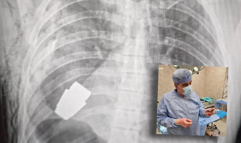 In sala operatoria con l’artificiere e il chirurgo In sala operatoria con l’artificiere e il chirurgo