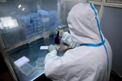 Tumore al pancreas, cure e ricerca. A che punto siamo