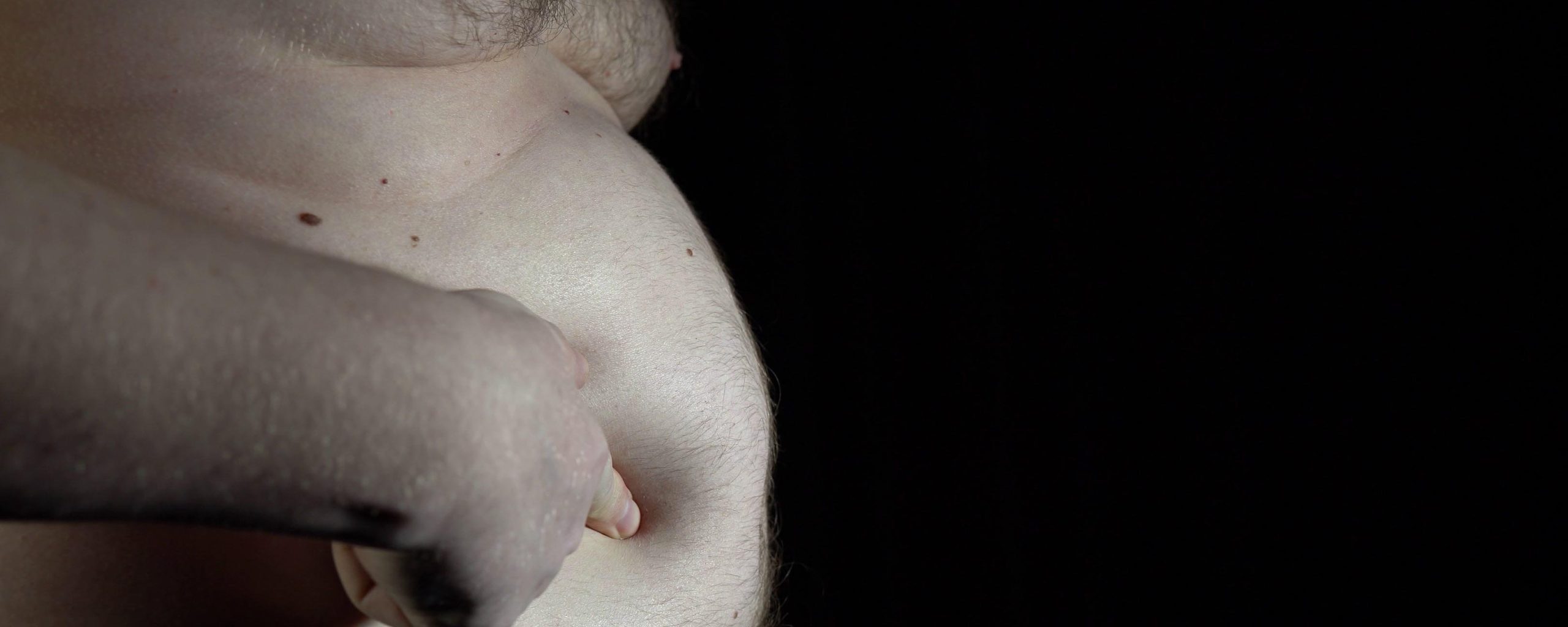 Il Regno Unito lascia senza cure gli obesi, ma paga cambio sesso e suicidio assistito Il Regno Unito lascia senza cure gli obesi, ma paga cambio sesso e suicidio assistito