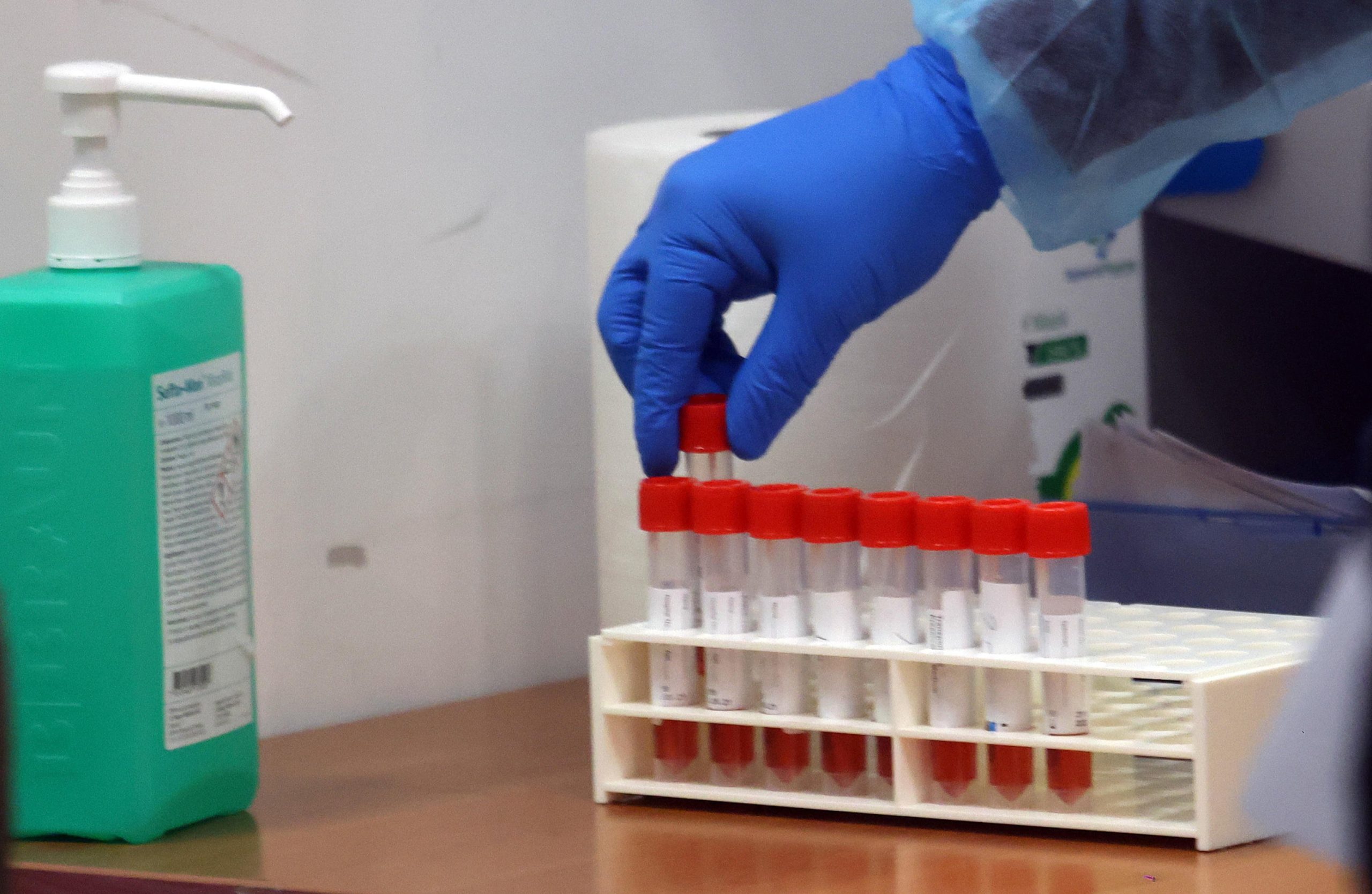 Covid, la Cina prevede nuova ondata virus con 65 milioni di casi a settimana