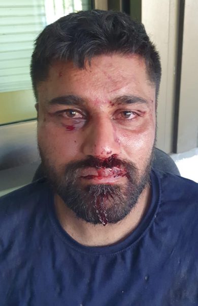 Bastone o carota… Cosa insegna la vicenda dello scippatore picchiato