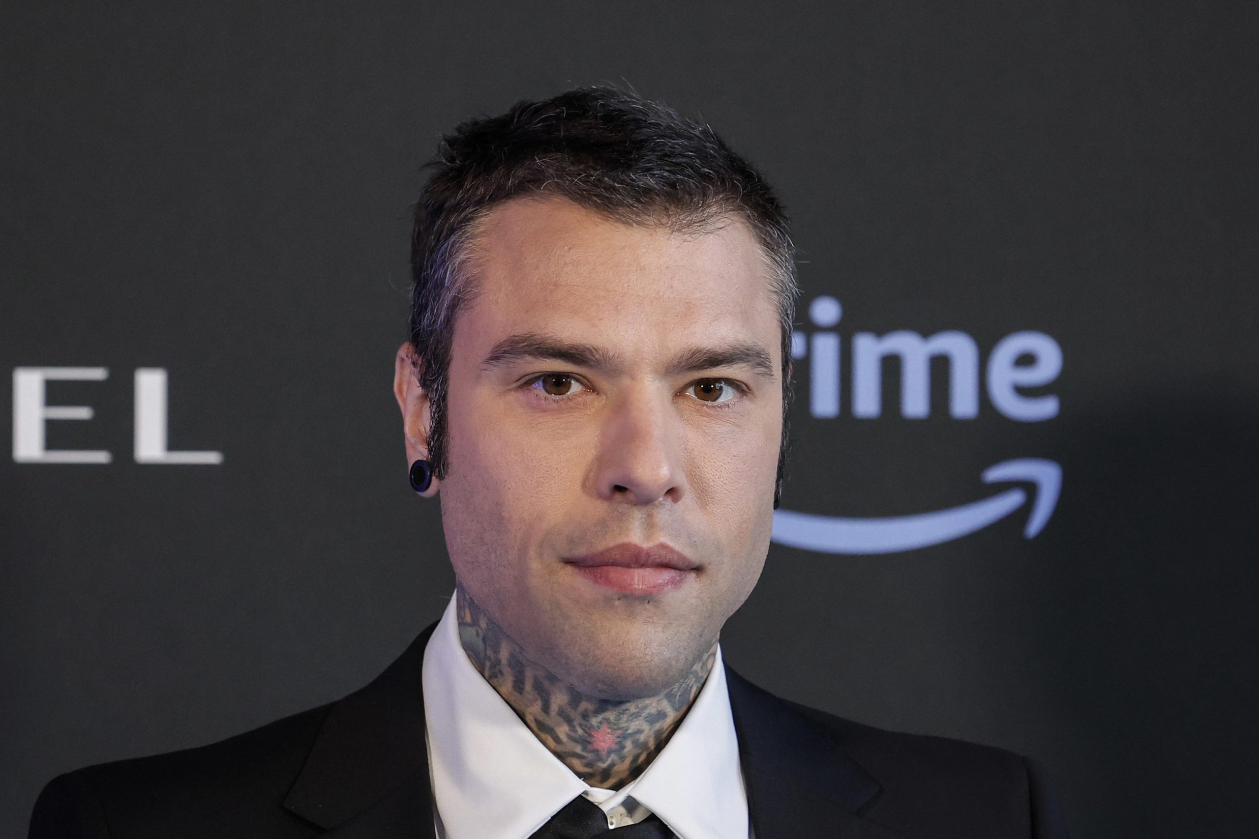 Fedez ancora ricoverato, nuovo sanguinamento e trasfusione