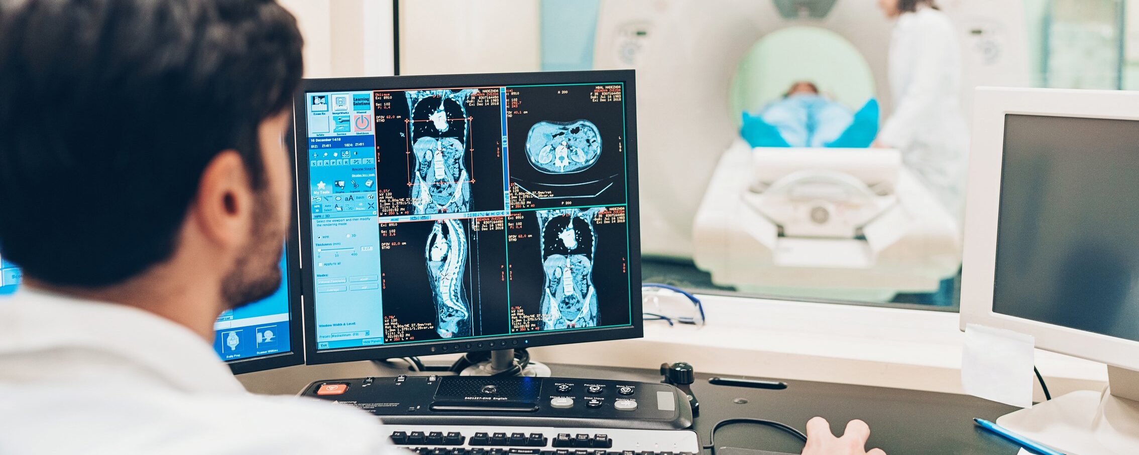 arrivano i permessi retribuiti per fare gli screening oncologici in orario di lavoro da Panorama.it arrivano i permessi retribuiti per fare gli screening oncologici in orario di lavoro