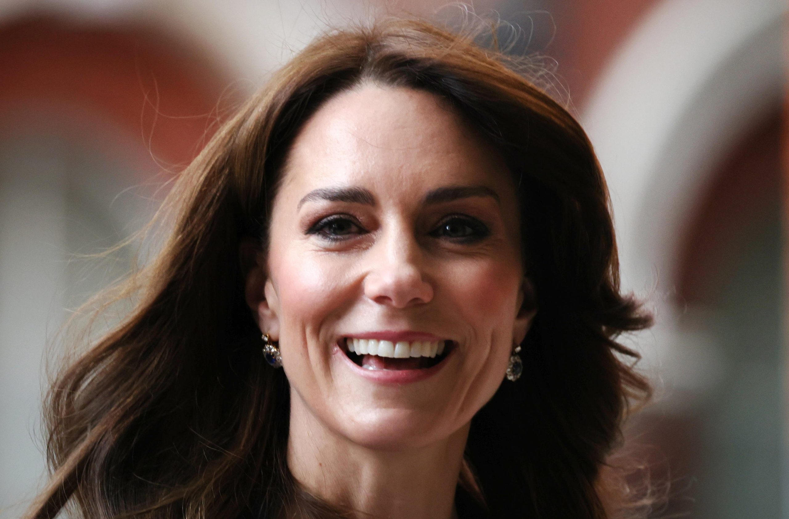 La principessa Kate operata all’addome