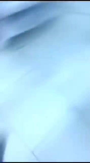 Ucraina, ospedale bombardato durante un’operazione | video