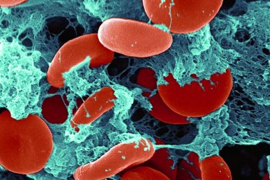 Anticorpi in tilt per eccesso di difesa