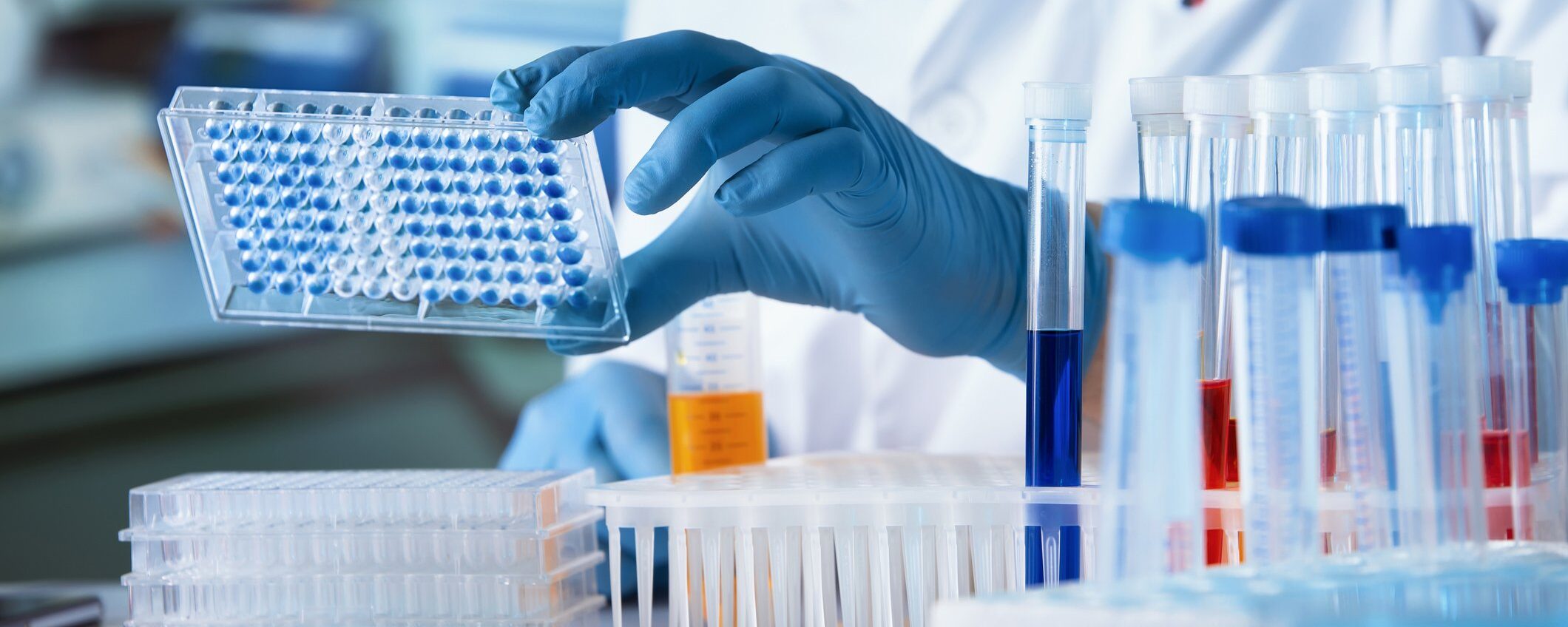 Virus Nipah, può diventare il nuovo Covid? Cosa sappiamo su sintomi, trasmissione e rischi Virus Nipah, può diventare il nuovo Covid? Cosa sappiamo su sintomi, trasmissione e rischi