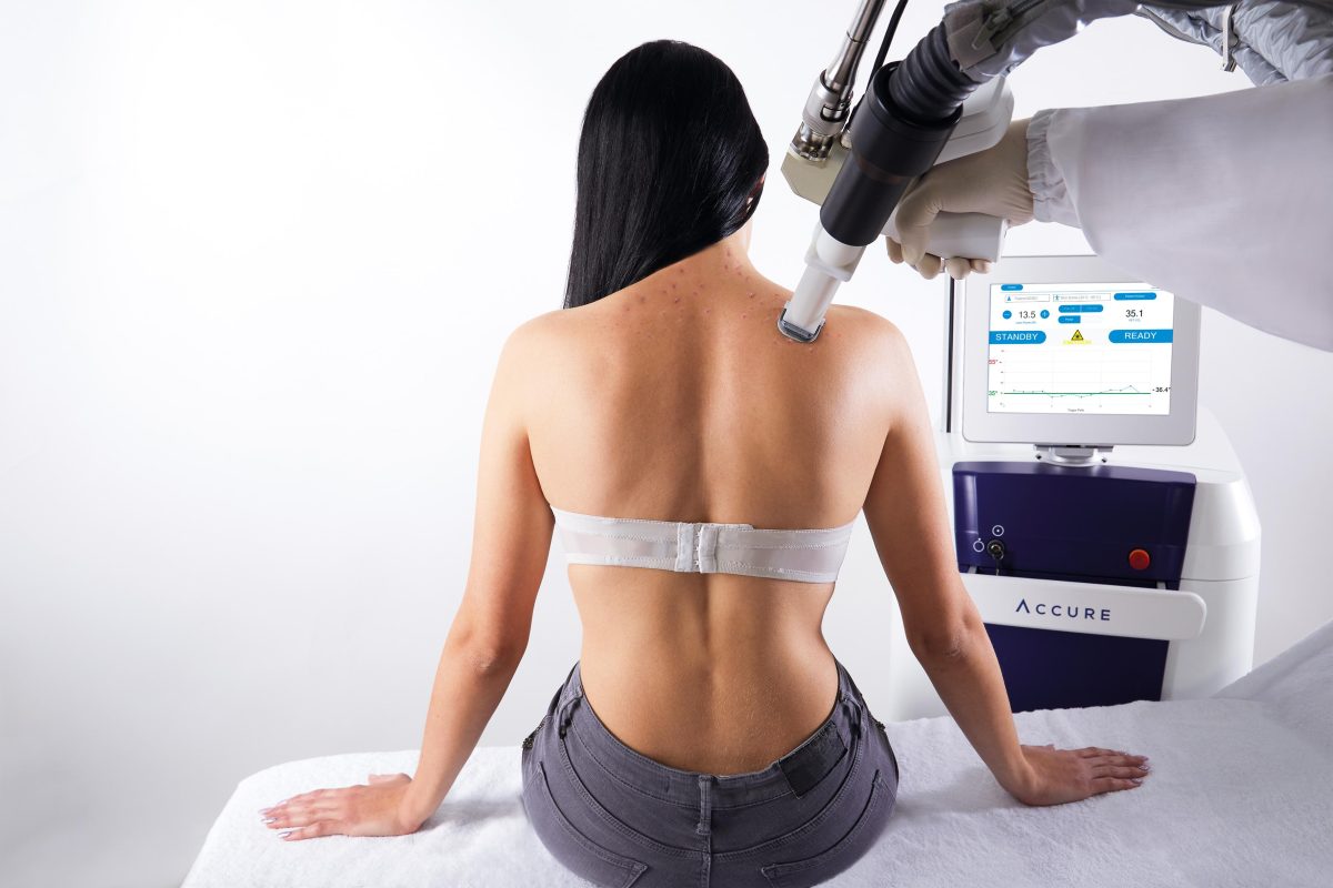 Galleria foto 'Come combattere l’acne' - foto 17