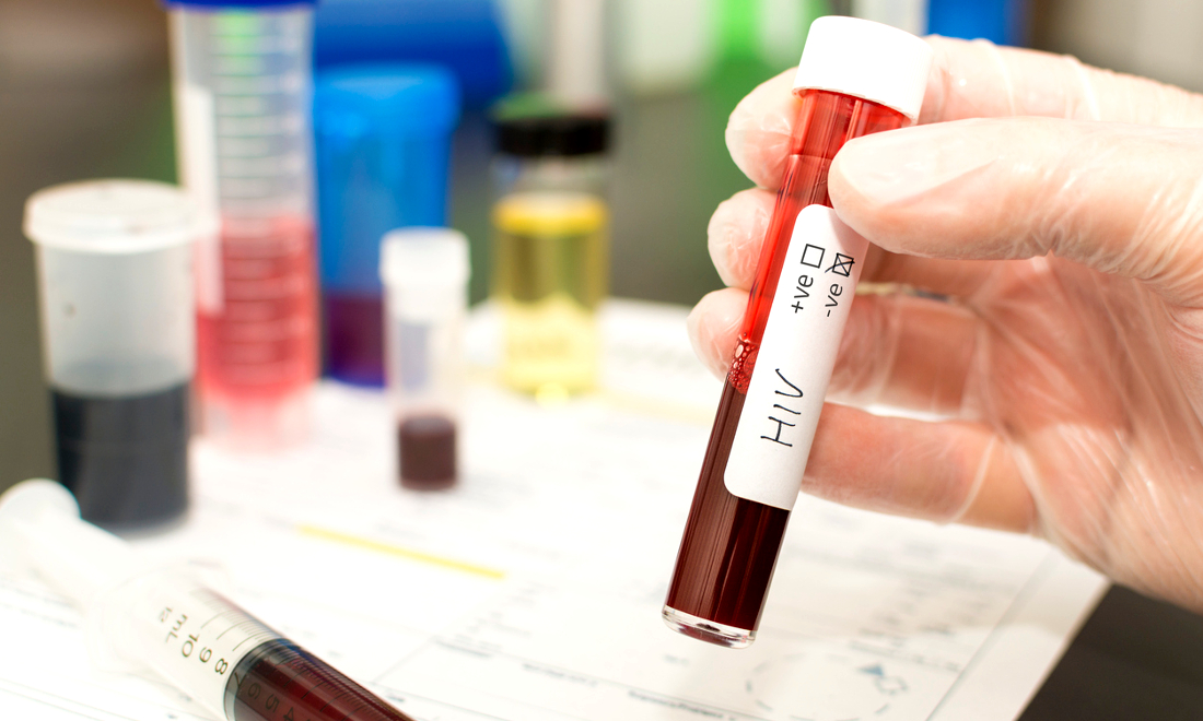 Il ritorno dell’HIV: l’allarme cresce in Italia, ma l’attenzione cala