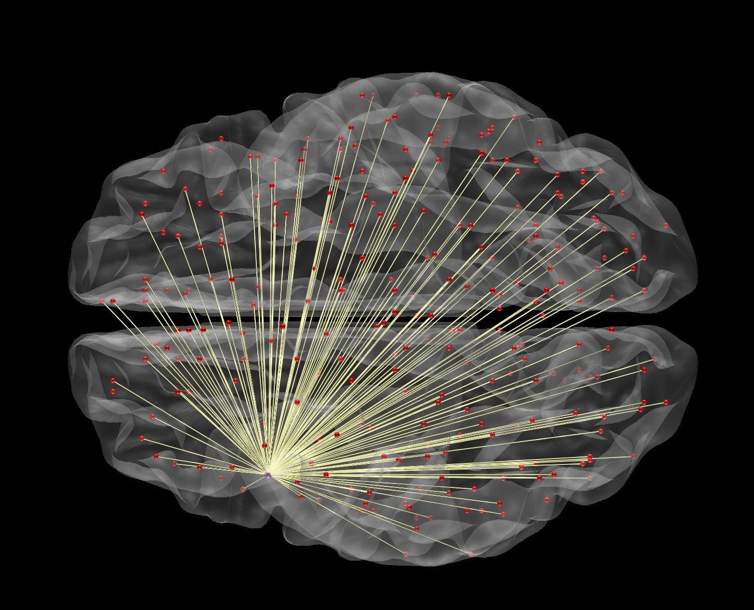 Una speranza contro l’Alzheimer. EMA approva nuovo farmaco