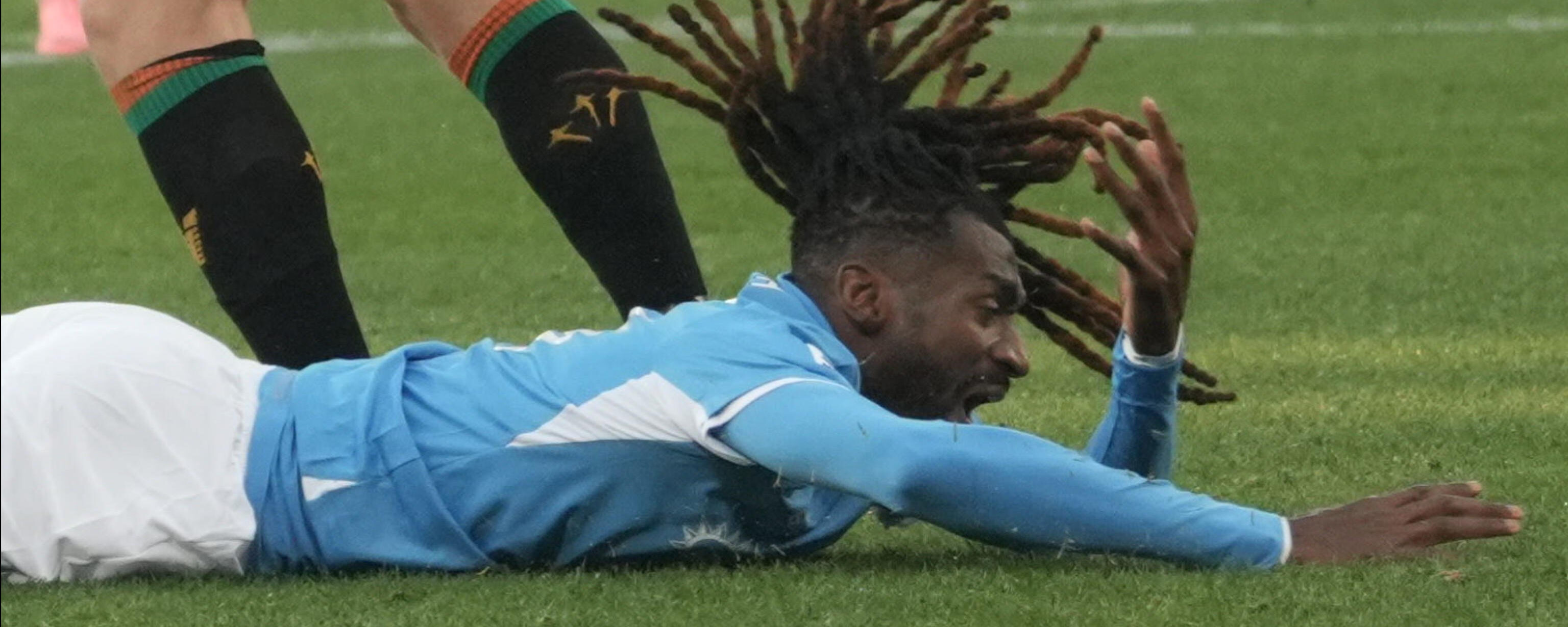 Infortuni in nazionale, come funziona il risarcimento ai club da parte della Fifa Infortuni in nazionale, come funziona il risarcimento ai club da parte della Fifa