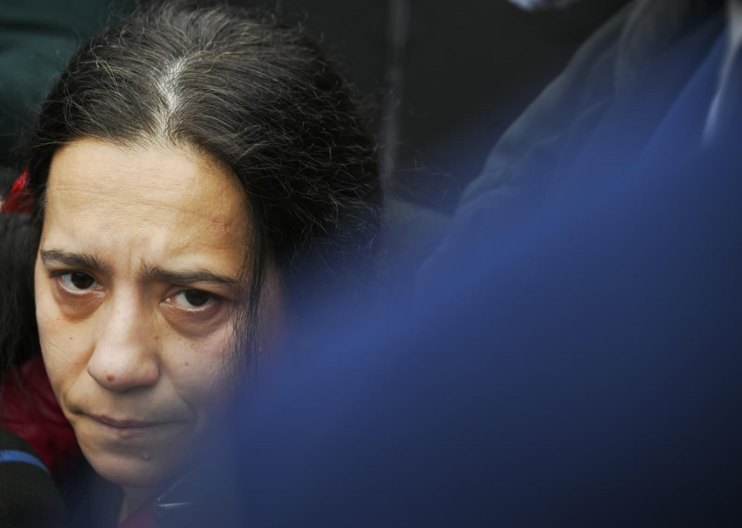 Cuore bruciato, gli esperti escludono un secondo intervento per il bimbo di due anni