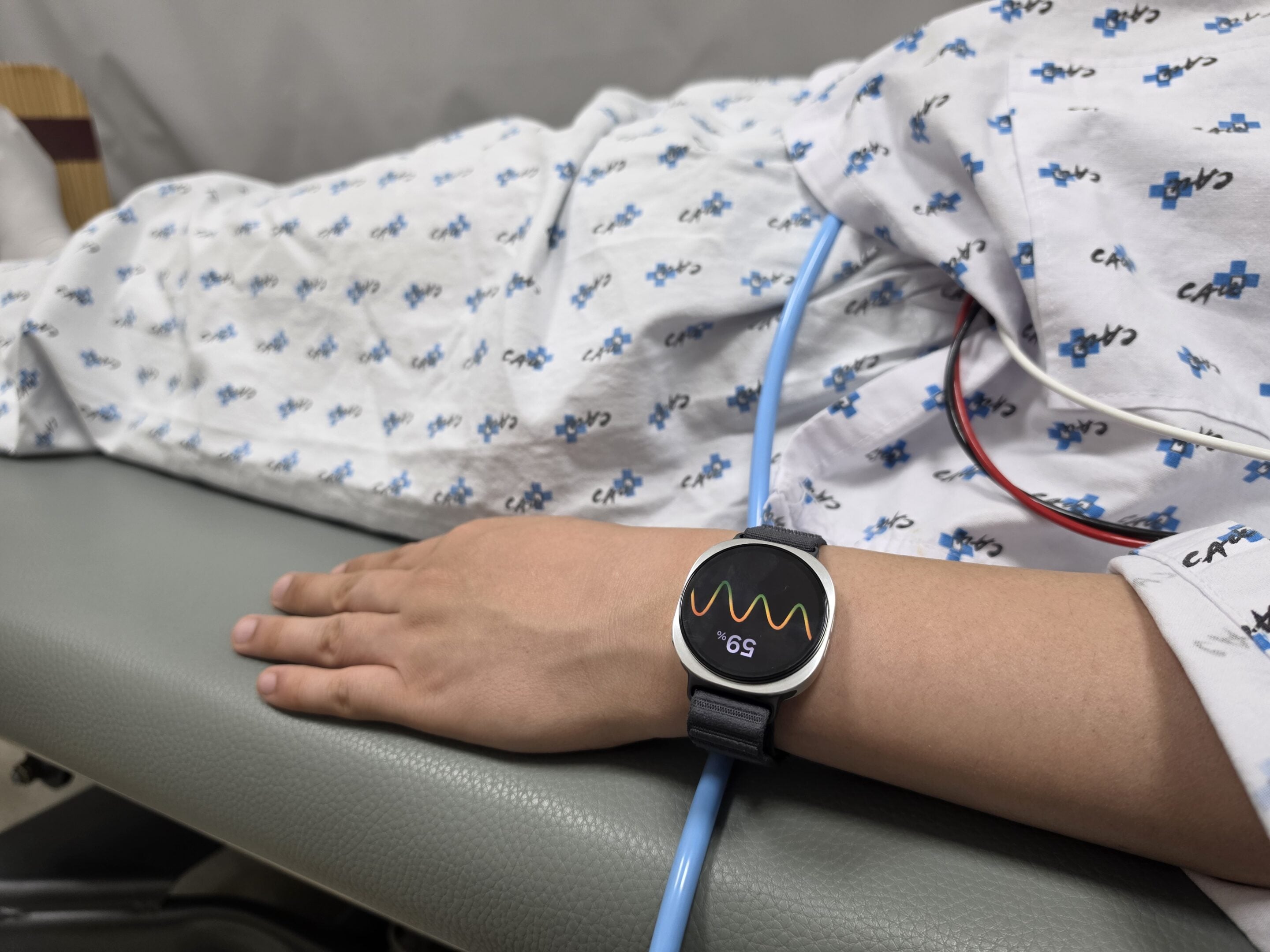Samsung Galaxy Watch, ora può prevedere gli svenimenti