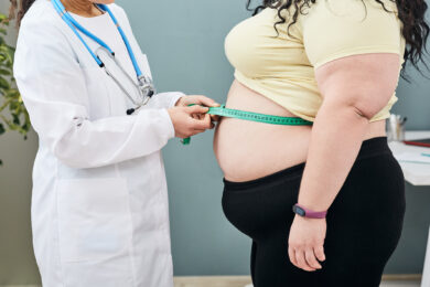Obesità, cresce soprattutto tra i giovani: boom di casi nelle donne under 35