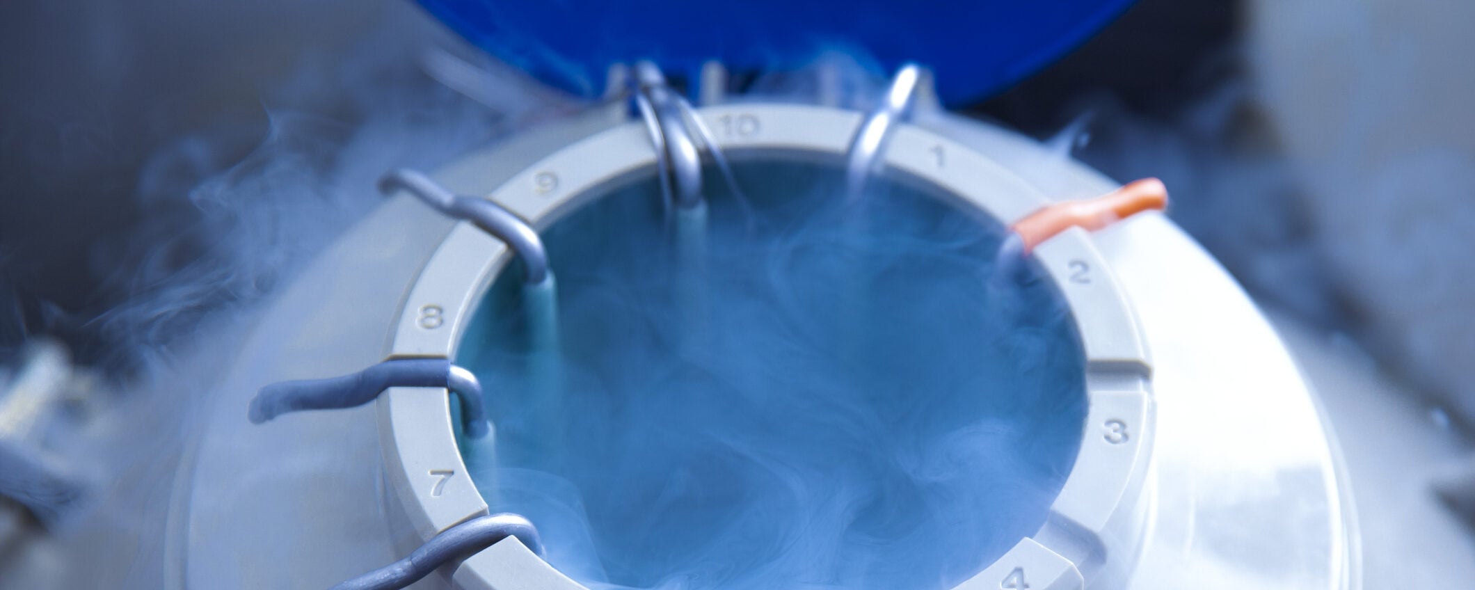 Social freezing, il congelamento degli ovuli per fermare il tempo: costi e aiuti regionali Social freezing, il congelamento degli ovuli per fermare il tempo: costi e aiuti regionali